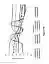 Fig. 77 - Lenses, devices, methods and systems for refractive error