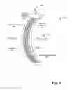 Fig. 05 - Electrochromic contact lens