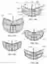 Fig. 14 - Topological change in a constrained asymmetrical subdivision mesh