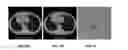Fig. 09 - System and method for image registration in medical imaging system