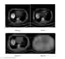 Fig. 13 - System and method for image registration in medical imaging system