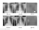 Fig. 16 - System and method for image registration in medical imaging system