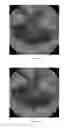 Fig. 09 - System and method for detecting anomalies in an image captured in-vivo using color histogram association
