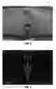 Fig. 06 - Drawbar scan solution for locating trailer hitch point