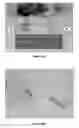 Fig. 06 - Identification and analysis of lesions in medical imaging