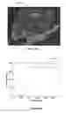 Fig. 07 - Identification and analysis of lesions in medical imaging