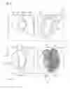 Fig. 02 - Method and apparatus for automated determination of contours in iterative reconstruction of image data