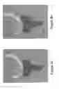 Fig. 03 - Method for determining contact position parameters of a joint connecting two bones