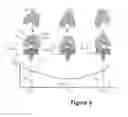 Fig. 08 - Method for determining contact position parameters of a joint connecting two bones