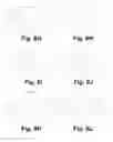 Fig. 09 - Perfusion method and apparatus