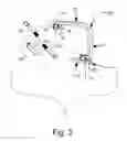 Fig. 04 - Action-set adjustable guitar neck attachment apparatus