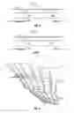 Fig. 04 - Guitar playing accessory