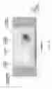Fig. 15 - Magnetic element, skyrmion memory, skyrmion memory-device, solid-state electronic device, data-storage device, data processing and communication device