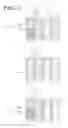Fig. 12 - Organic light emitting diode display device