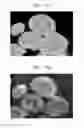 Fig. 13 - Composite positive active material, method of preparing the same, positive electrode including the composite positive active material, and lithium battery including the positive electrode