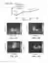 Fig. 14 - Communicating through physical vibration