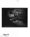 Fig. 16 - Calibration of defective image sensor elements