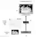 Fig. 01 - Method and apparatus for augmenting media services