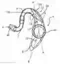 Fig. 01 - Device for transmitting sounds for intra-auricular earpiece and intra-auricular earpiece