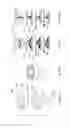 Fig. 31 - Apparatus and methods for audio-tactile spatialization of sound and perception of bass