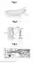 Fig. 05 - Condenser microphone unit and condenser microphone
