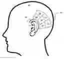 Fig. 01 - Neutralizing the effect of a medical device location