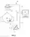 Fig. 07 - Neutralizing the effect of a medical device location