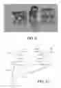 Fig. 06 - HEARING DEVICE COMPRISING A SENSOR FOR PICKING UP ELECTROMAGNETIC SIGNALS FROM THE BODY
