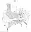 Fig. 02 - IMPLANTABLE HEARING PROSTHESIS WITH DUAL ACTUATION