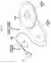 Fig. 04 - IMPLANTABLE HEARING PROSTHESIS WITH DUAL ACTUATION