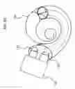Fig. 05 - IMPLANTABLE HEARING PROSTHESIS WITH DUAL ACTUATION