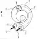 Fig. 06 - IMPLANTABLE HEARING PROSTHESIS WITH DUAL ACTUATION