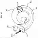 Fig. 08 - IMPLANTABLE HEARING PROSTHESIS WITH DUAL ACTUATION