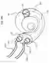 Fig. 25 - IMPLANTABLE HEARING PROSTHESIS WITH DUAL ACTUATION