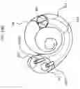 Fig. 26 - IMPLANTABLE HEARING PROSTHESIS WITH DUAL ACTUATION
