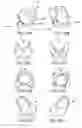 Fig. 22 - Functional brassiere