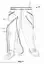 Fig. 07 - ZIPPERED PANTS AND METHOD OF USE