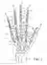 Fig. 03 - Glove with expandable finger stall