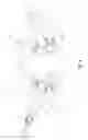 Fig. 05 - Mask coupling apparatus