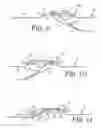 Fig. 05 - Multifunctional strap with fastener having concealed tool bits