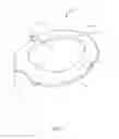 Fig. 02 - Kit And Method For Stabilization of a Toilet Seat