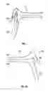 Fig. 02 - SLEEVE FOR SPECULUM AND USE THEREOF
