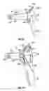 Fig. 08 - SLEEVE FOR SPECULUM AND USE THEREOF