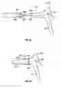 Fig. 09 - SLEEVE FOR SPECULUM AND USE THEREOF