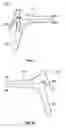 Fig. 02 - INSERTABLE SLEEVE FOR SPECULUM AND USE THEREOF