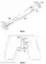 Fig. 06 - INSERTABLE SLEEVE FOR SPECULUM AND USE THEREOF
