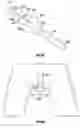 Fig. 07 - INSERTABLE SLEEVE FOR SPECULUM AND USE THEREOF