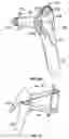 Fig. 17 - INSERTABLE SLEEVE FOR SPECULUM AND USE THEREOF