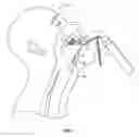Fig. 08 - Intubation device