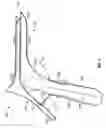 Fig. 02 - ERGONOMICALLY DESIGNED VAGINAL SPECULUM